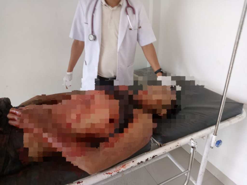 Sopir Truk Pengangkut Sawit Tewas Ditempat Usai Ditikam Oknum Security PT&nbsp;Sogun